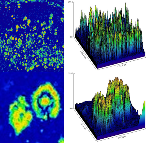 Characterization of amyloid plaques