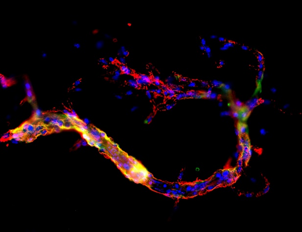 Isolated microvessels immunofluorescence